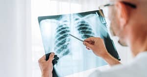A crescut îngrijorător numărul cazurilor de cancer pulmonar la nefumători. Ce spun specialiştii despre principala cauză