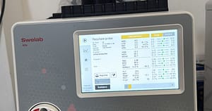 Aparatul care îi scapă pe bebeluși de traume. „Vom recolta din degețel, așa cum se recoltează o banală glicemie”